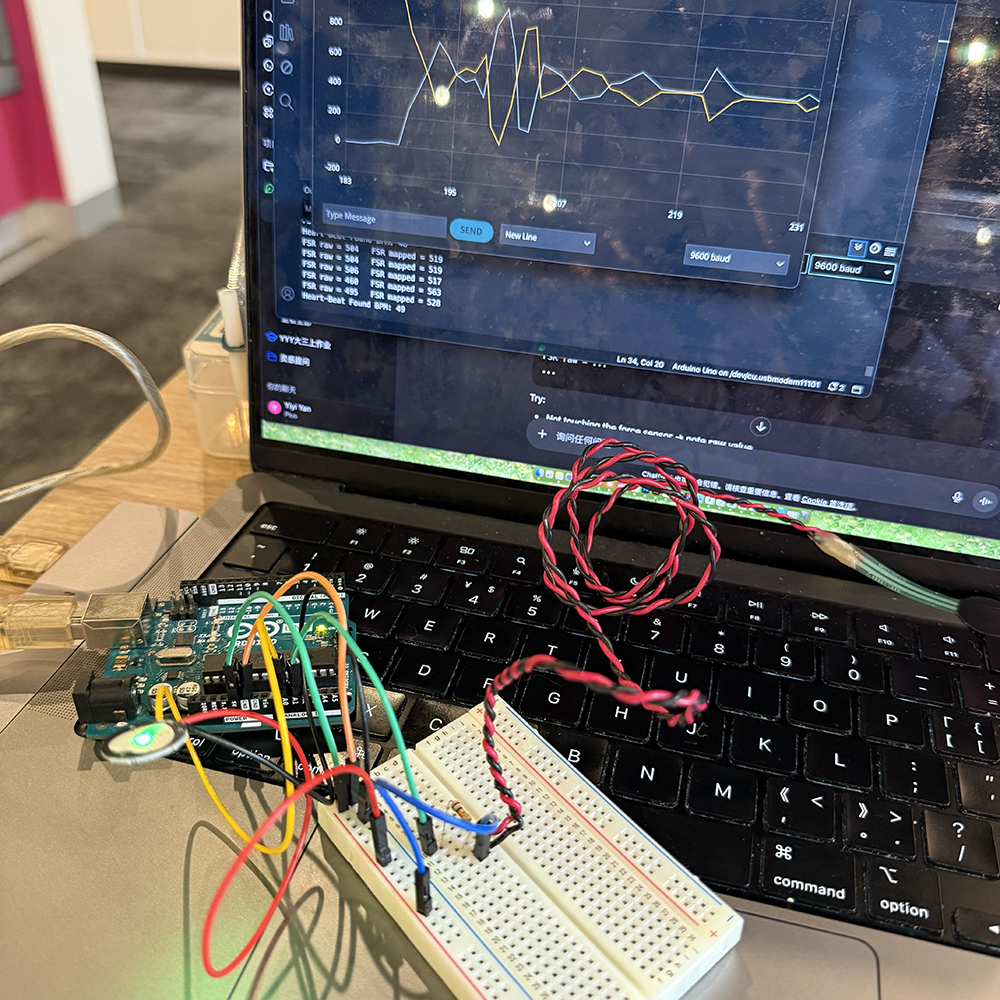 Looking at the chart shown on serial monitor's live chart, it shows that the pulse sensor that we used was active when we interact with it by holding the sensor using our hands. This chart shows the real time data for pulse sensor of when we hold with the sensor.